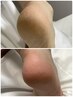 フット角質ケアコース《ジェルしててもできる》※甘皮ケア・爪形成なし