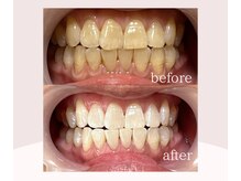 ココビ 津高店(COCO美)/