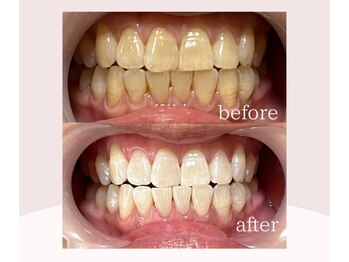 ココビ 津高店(COCO美)/