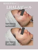 フォルディオ(FORDIO)/ララピール[札幌/円山]