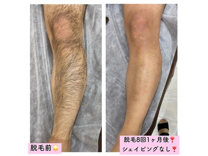 エスポワール(Espoir)の写真