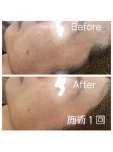 チル アウト(CHILL OUT)/イラストリアス