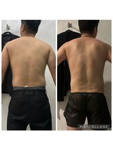 エクラ(Eclat)/Eclatの痩身★BeforeAfter14