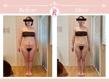 サロン アール(Salon R)/痩身施術×食事・インナーケア