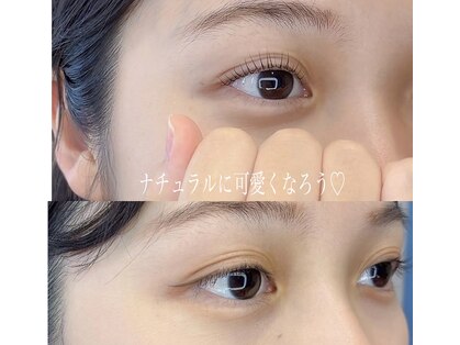 ヴィクトリア アイ(victoriaeye)の写真