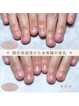 ジェル育成