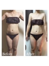 チャンティック(Cantik)/Befor/After　