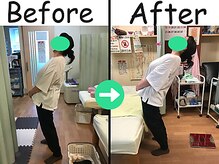 杉本接骨鍼灸院/看護師で腰を痛めた【骨盤矯正】