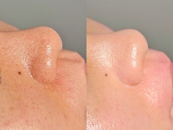 ルーナジェーナ(Luna llena)/池袋 エステ ルーナジェーナ