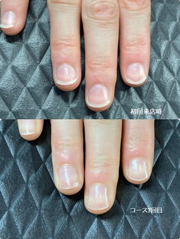 クーラ アンド ベリッシモ(Cura&Bellissimo)/最強ケア!3ヶ月集中コース