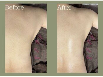 リヴィタ 仙台/ハーブのみで痩身効果◎