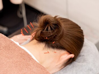 横浜杉田鍼灸院 深部整体院の写真/<美容鍼>親切丁寧な施術×全スタッフ国家資格保持!!鍼が怖かった方・初めてで不安な方も◎初回半額