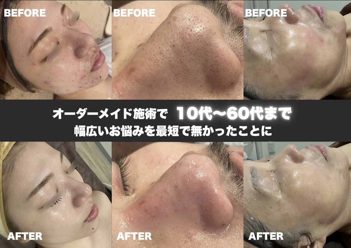 レア(le'a)｜ホットペッパービューティー