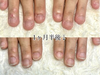 グラシナ 鳥丸店/(深爪/長さだし/フィルイン/)