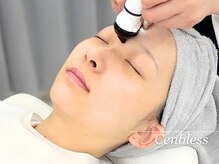 ビューティスタジオ センブレス(Cenbless)/プラズマリフト