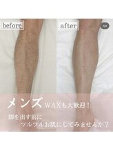 ブルーム(bloom)/ブラジリアンワックス/メンズ