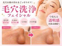 ベル アージュ