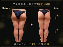 リオ(Rio)/【痩身/足/脂肪燃焼10ml】