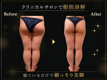 リオ(Rio)/【痩身/足/脂肪燃焼10ml】