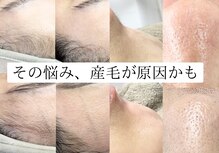 エヌクレアール(Ncrear)