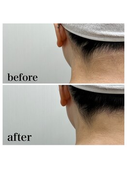 ラクシー 御徒町(luxssy)/うなじシェービング