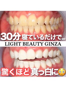 ライトビューティー 銀座店(LightBeauty)/ホワイトニングで好感度アップ