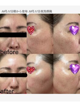 レクレア/エクソソーム原液