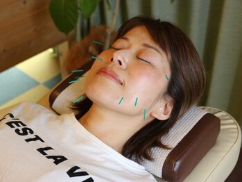 たまき はりきゅう院の写真/地域で愛される実力派サロン！美容鍼でしわ・たるみ改善でリフトアップ♪水素吸入の２stepで今日から実感◎