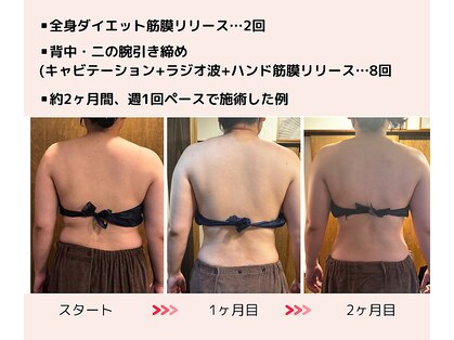 アマテ(Amate)の写真