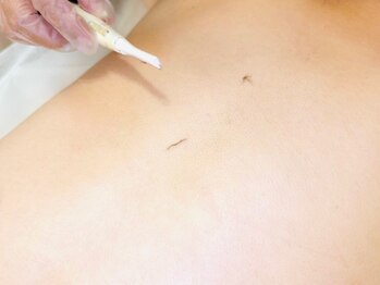 テテアテテ(tete a tete)/背中のシェービング