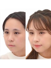 メゾンカラクル/お客様before→after