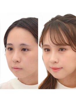 メゾンカラクル/お客様before→after