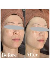 ルタンリッシュ ハナレ(Lutan Riche 花麗)/