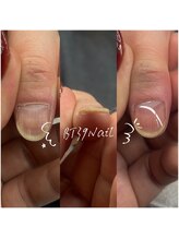 ビーティーサンキューネイル(BT39_Nail)/