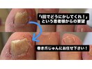 一回の施術でどうにかして！