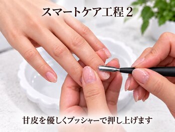 ピアシェ(Piache)/スマートケア2 ウォーターケア付