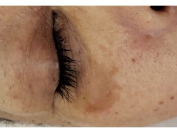 ピアーノ(PIANO)/エルモサハーブピーリング