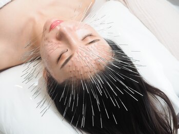 ランスソア(L'ins soi)/鍼 ルート鬼美容鍼