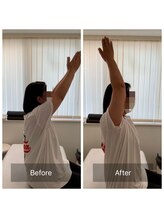 ナオル整体 新宿院(NAORU整体)/30代女性-猫背矯正Before/After