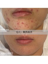 アール アンド ビューティーサロン(Ｒ＆ BeautySalon)/ホームケアもサポート致します！