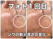 リエル(RIEL)/【フォト】