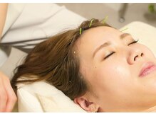 アモ(amo)/頭皮鍼