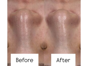 メイス 福井店(MEIS)/お客様Before、After