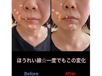 美容矯正サロン レレポノ(LELEPONO)/