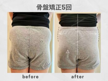 ビトリア 横浜店(BITORIA)/骨盤胸椎矯正