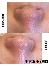 マヴィ 守口店(MavY.)/サロンで毛穴よごれすっきり！