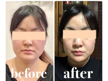 クリーム 京都店(Cream)/アゴが変わると雰囲気まで変わる