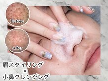 エサージュオム 銀座エスト店/小鼻の汚れ撃退★