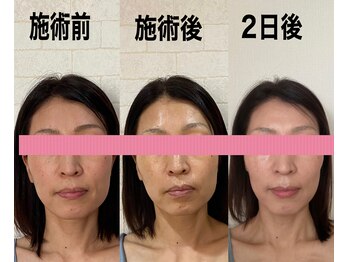 サロンドミジュ(Salon de 美jyu)/小顔・骨格矯正　40代
