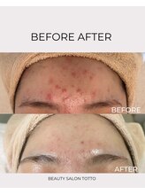 トット 恵比寿(totto)/ケア症例